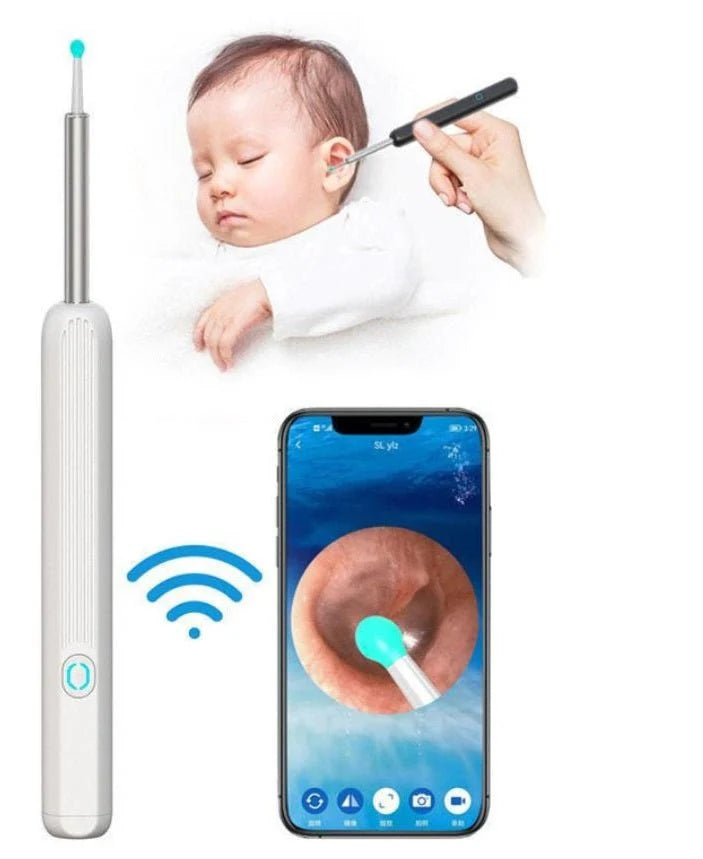 Earwax Removal Kit – Smart Visual Earwax Removal Tool&nbsp;👂📱